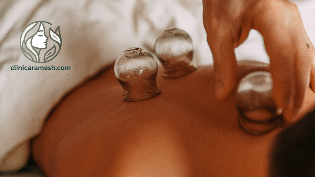 Glass cupping on shoulders promoting blood circulation