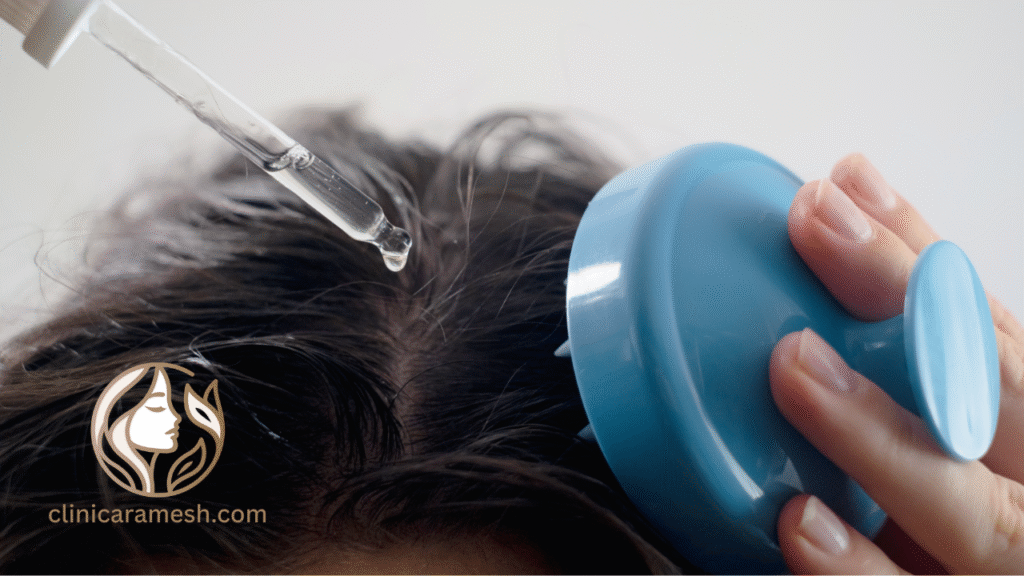 Patient applying topical cream on the scalp to soothe and treat psoriasis symptoms